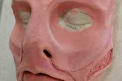 Protesis hombre pez (proceso)